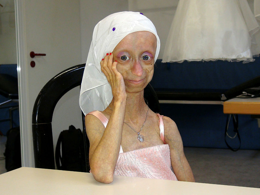 Gamze acılarına daha fazla dayanamadı