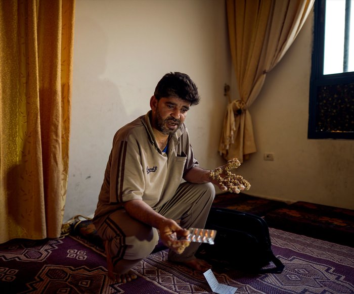 Ağaç adam ameliyat olmayı bekliyor!