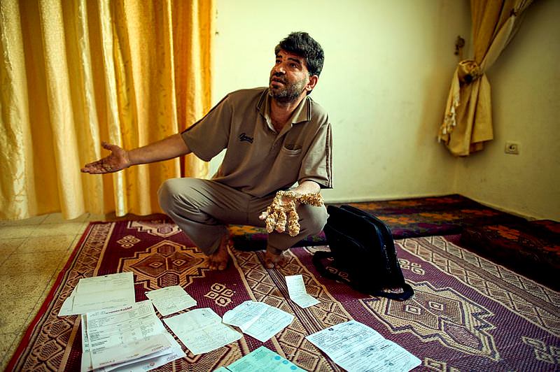 Ağaç adam ameliyat olmayı bekliyor!