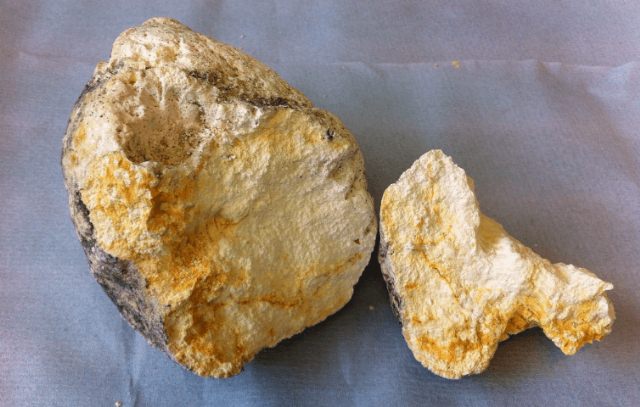 Balina kusmuğu bulan balıkçılar zengin oldu