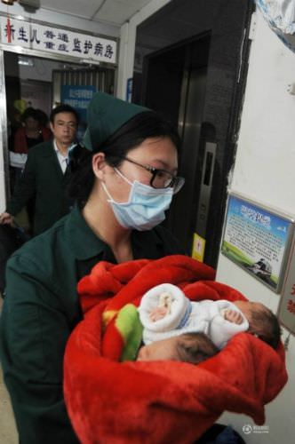 Böyle ikiz görülmedi