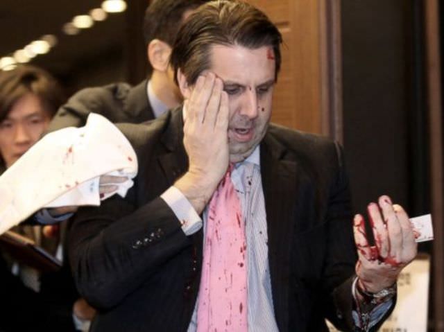 Usturalı saldırı sonrası taburcu oldu