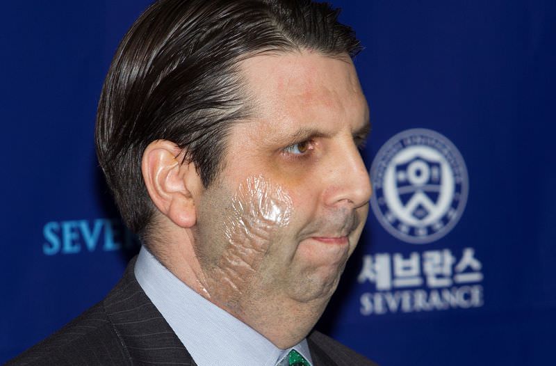 Usturalı saldırı sonrası taburcu oldu