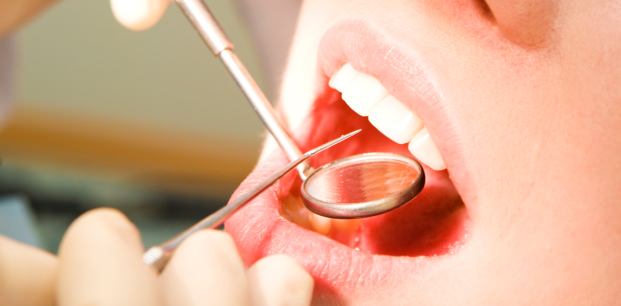Diş eti kanamalarını hafife almayın çünkü… Sayfa 5 Sağlık Haberleri