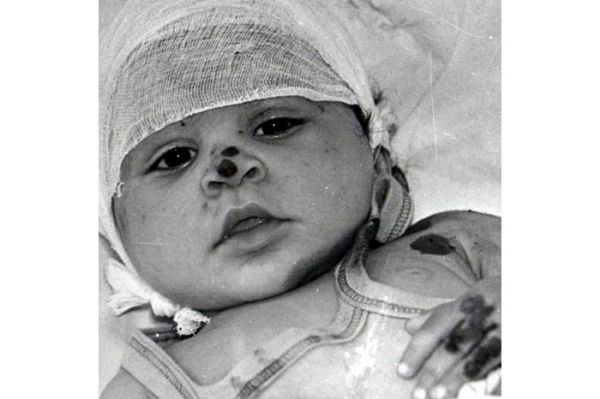 Dünyanın sustuğu katliam: Hocalı