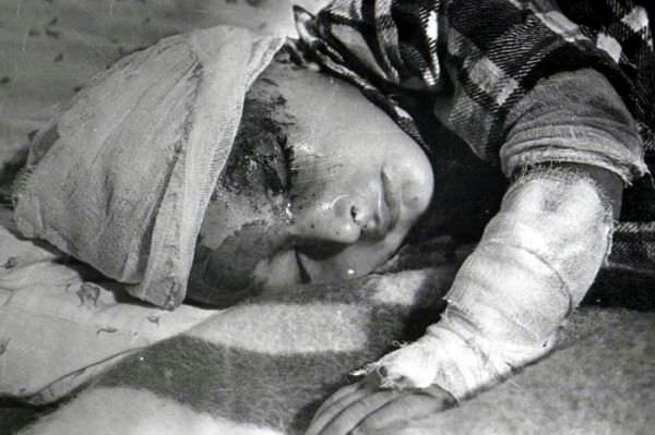 Dünyanın sustuğu katliam: Hocalı