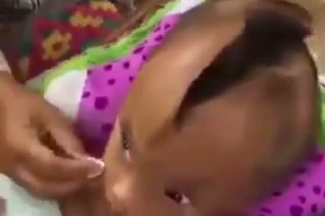 Kafasında dev bir yarıkla doğdu!