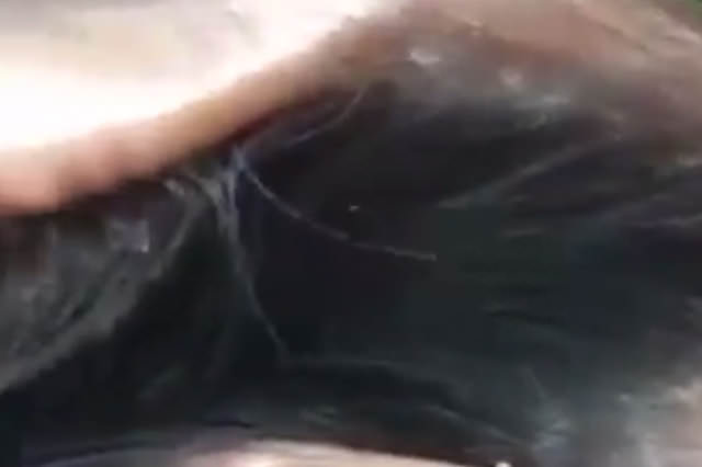 Kafasında dev bir yarıkla doğdu!