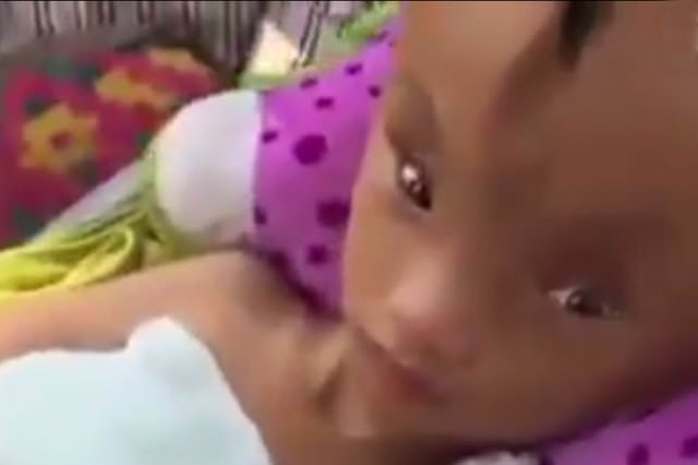 Kafasında dev bir yarıkla doğdu!