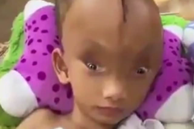 Kafasında dev bir yarıkla doğdu!