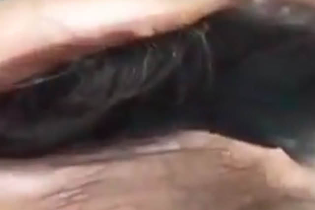 Kafasında dev bir yarıkla doğdu!