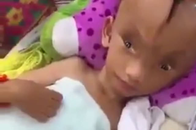 Kafasında dev bir yarıkla doğdu!