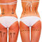 Bu yaz popo esteti�i liposuction�� sollayacak!