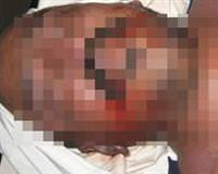 Bel�ika'da i�kenceyle �len T�rk