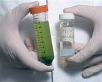 AIDS'in bula�mas�n� �nleyen a��