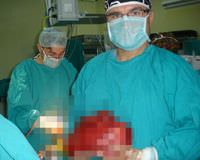 Hentbol topu b�y�kl���nde t�mor