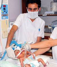 Siyam ikizleri i�in �aba