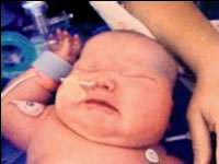 7 kiloluk erken do�um