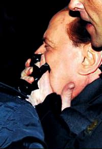 Silvio'ya sald�r� d�zmece mi?