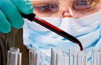 40 y�ll�k 'prostat hatas�' t�bb� b�ld�