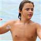 Jackson�n o�lu da vitiligo oldu