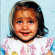 Yaseminin g�zleri iki farkl� renkte