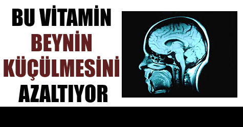 Alzheimera �are mi?
