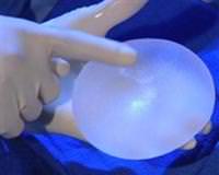 Avrupa'da sahte g���s implant� alarm�