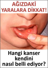 Kanser belirtileri nelerdir?