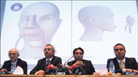 Gazi, y�z naklini 'damardan' ba�lad�