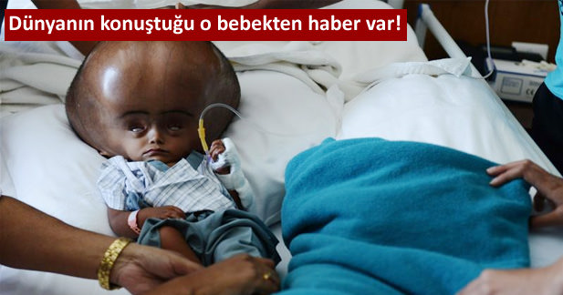Dünyanın konuştuğu o bebekten haber var