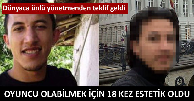Oyuncu olabilmek için 18 kez estetik oldu