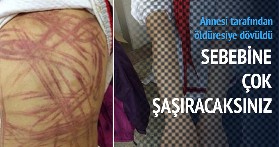 MASALINI BİLEMEDİ DİYE ÖLDÜRESİYE DAYAK